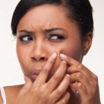 stop-acne-black-women